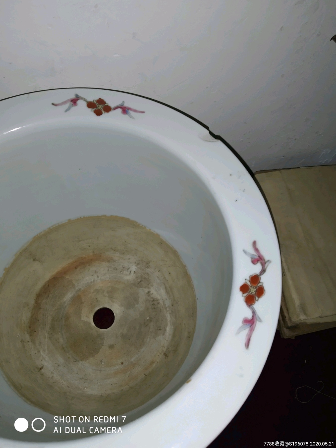 河南小伙整形后眉毛不会动了医院:正常现象‘IM电竞官网’(图3) IM电竞